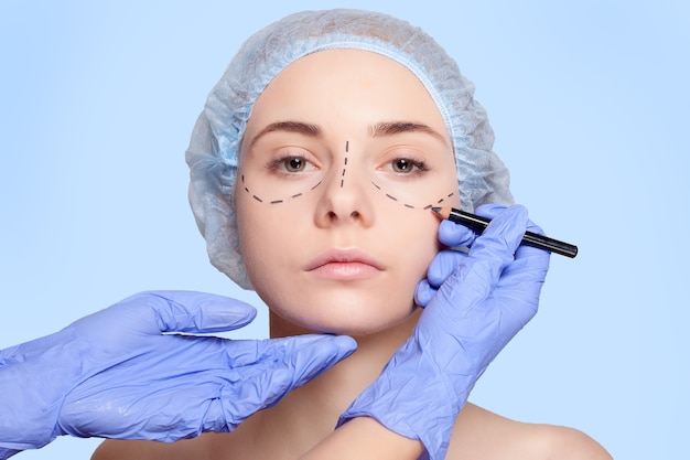 Piękna młoda kobieta z liniami perforacji na twarzy przed operacją plastyczną