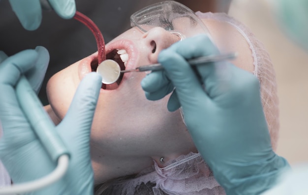 Piękna młoda kobieta ze zdrowymi zębami na białym tle portret zbliżenie pacjentki vi