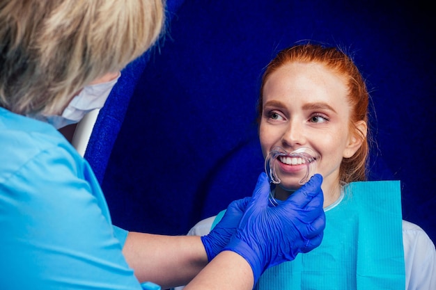 Piękna ruda kobieta imbir z otwartymi ustami i ustnik u dentysty sobie plastikową tackę do wybielania.