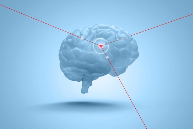 Pielęgnacja mózgu z laserowym niebieskim tłem - renderowanie 3D