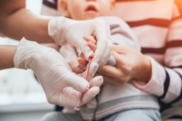 Pielęgniarka pobiera małe próbki krwi dziecka. Wyposażenie medyczne.
