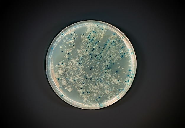 Płytka agarowa z koloniami bakteryjnymi na ciemnej ścianie