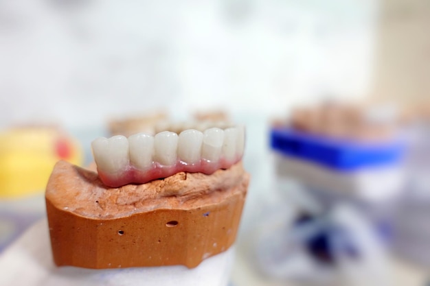 Płytka do zębów z porcelany cyrkonowej w sklepie dentystycznym Makro szczegółowe zdjęcie