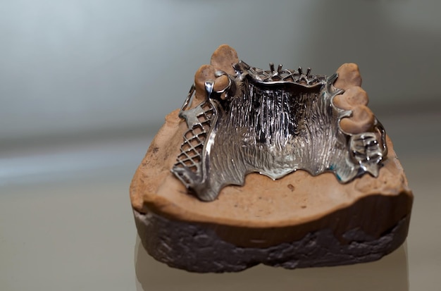 Płytka na zęby z porcelany cyrkonowej w sklepie dentystycznym Fot