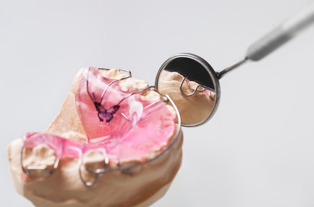 Zdjęcie płytka ortodontyczna ze śrubą nowoczesna wykonana z kolorowego tworzywa sztucznego