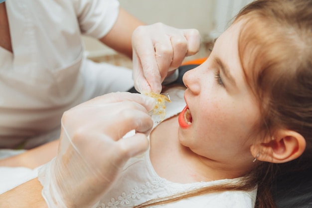 Portret dziewczynki z otwartymi ustami, siedzącej na fotelu dentystycznym, podczas gdy ortodonta trzyma talerz na zębach Dentysta wkłada talerz do ust dziecka