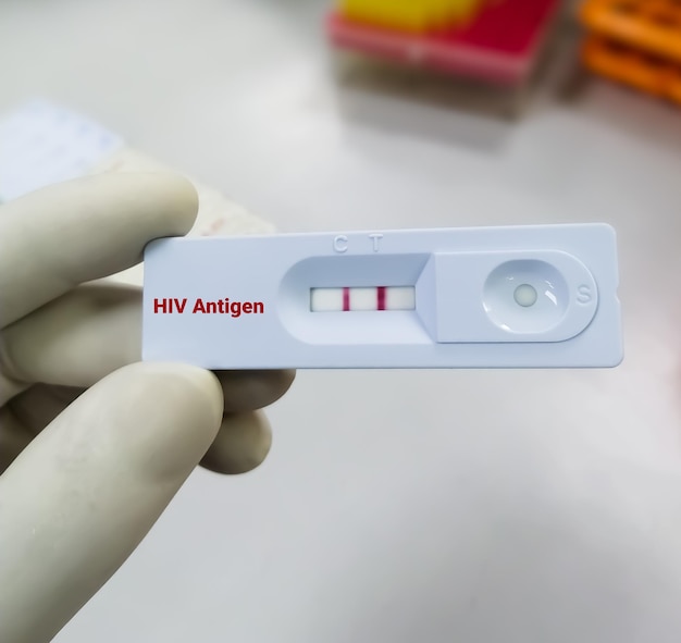 Pozytywny Wynik Testu Na Obecność Antygenu Hiv Przy Użyciu Kasety Szybkiego Testu