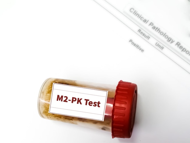 Próbka kału do testu kinazy M2-PK lub M2-pirogronianowej.