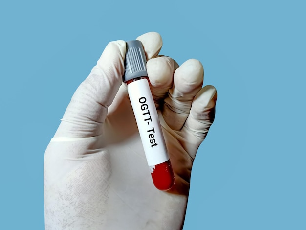 Próbka krwi do doustnego testu tolerancji glukozy OGTT Trzy lub pięć Próbki do badania diagnostycznego