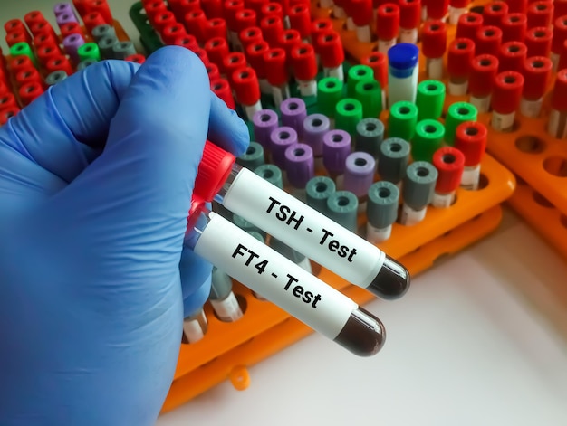 Próbka krwi do testu TSH i FT4 do diagnozy choroby tarczycy