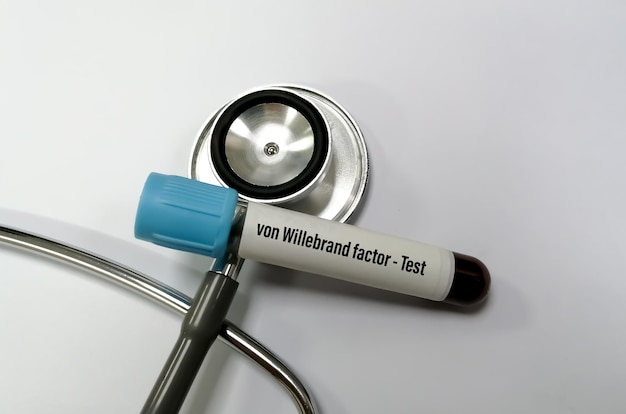 Próbka krwi do testu vWF lub czynnika von Willebranda w celu zdiagnozowania zaburzeń krzepnięcia