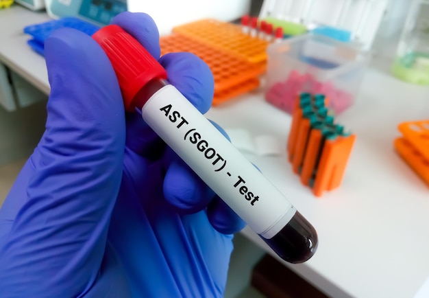 Próbka krwi izolowana do testu AST lub SGOT do testu czynności wątroby