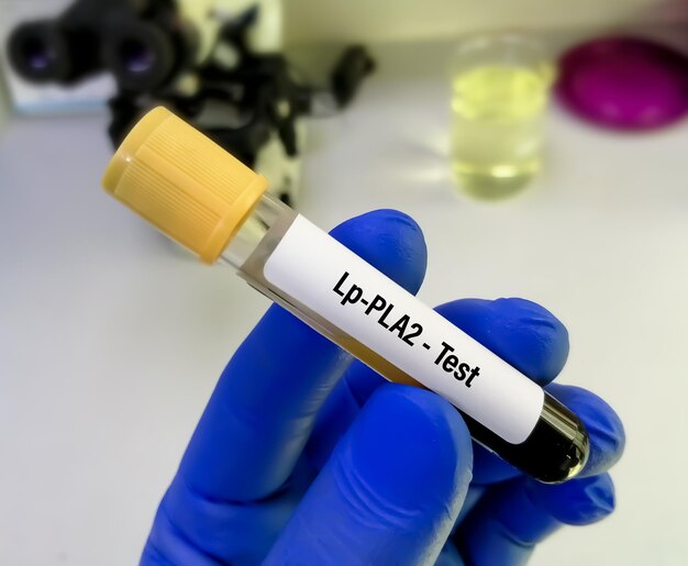 Próbka krwi na LpPLA2 lub test na fosfolipazę A2 związaną z lipoproteiną