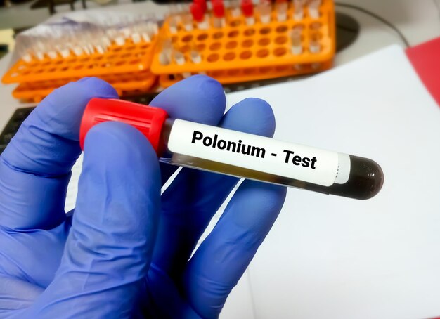 Zdjęcie próbka krwi na polon test na metale ciężkie do diagnozy toksyczności polonu