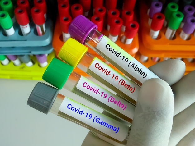 Zdjęcie próbki krwi do różnych rodzajów testów wariantu covid 19