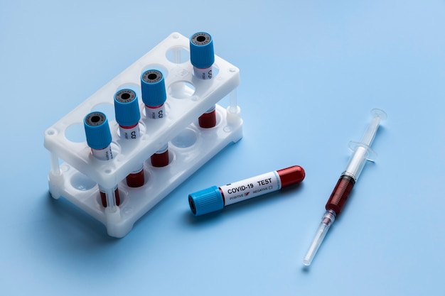 Zdjęcie próbki krwi do testu covid w laboratorium