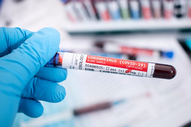 Próbki krwi z zainfekowanym wirusem