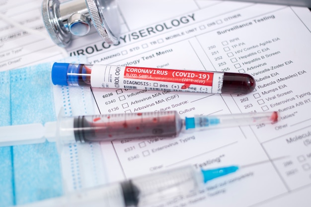 Próbki krwi z zainfekowanym wirusem