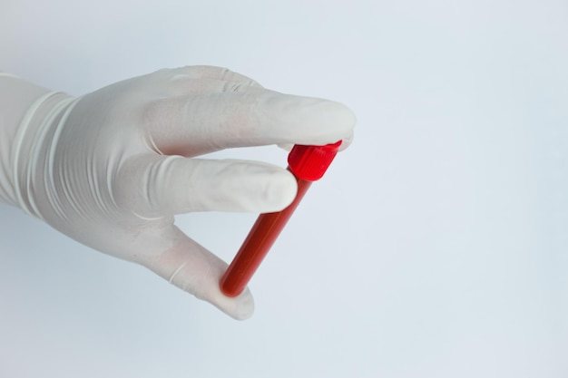 Probówka na krew do wykrywania wirusa. Probówka z czerwonym płynem w ręku. Ręka pracowników medycznych.