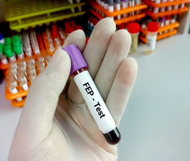 Probówka na próbkę krwi do testu FEP lub wolnej protoporfiryny w erytrocytach w diagnostyce niedokrwistości