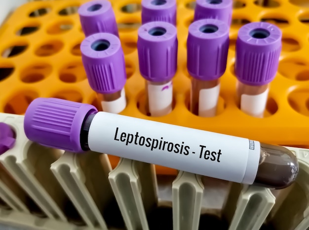 Zdjęcie probówka na próbkę krwi do testu leptospirozy w laboratorium