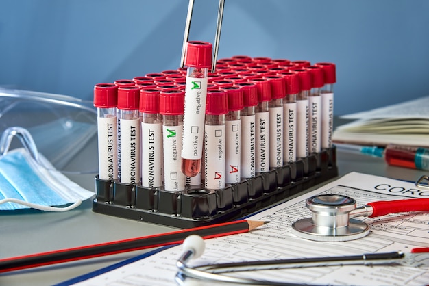 Probówka w pincecie z ujemnymi próbkami krwi na COVID-19 obok formularza testu na koronowirusa.