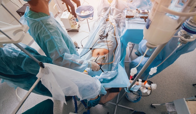 Proces operacji chirurgii ginekologicznej przy użyciu sprzętu laparoskopowego. Grupa chirurgów w sali operacyjnej ze sprzętem chirurgicznym