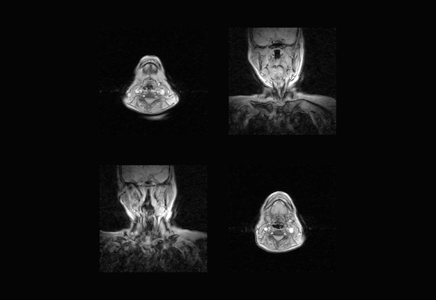Profesjonalne zdjęcia rentgenowskie kręgosłupa szyjnego i tomografia komputerowa