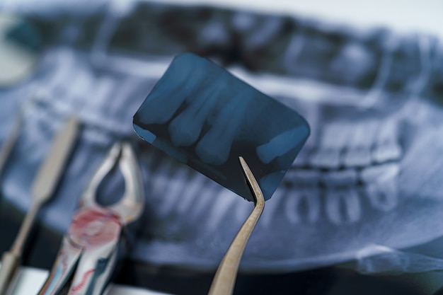 Proteza i instrumenty dentystyczne. RTG panoramiczne szczęki. Indywidualne leczenie stomatologiczne. Metalowe instrumenty stomatologiczne.