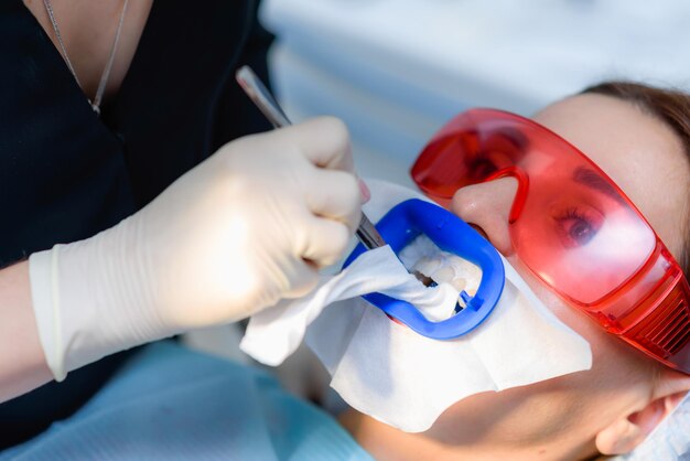 Zdjęcie przygotowanie jamy ustnej do wybielania lampą ultrafioletową zbliżenie