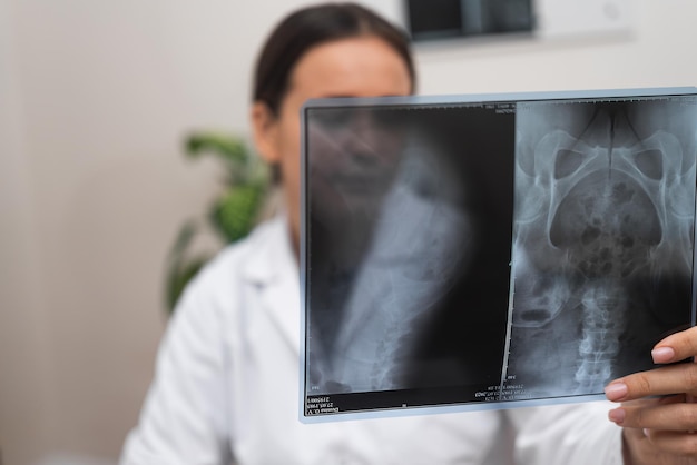 Radiografia diagnostyczna ocena choroby przez lekarza przy użyciu filmu rentgenowskiego