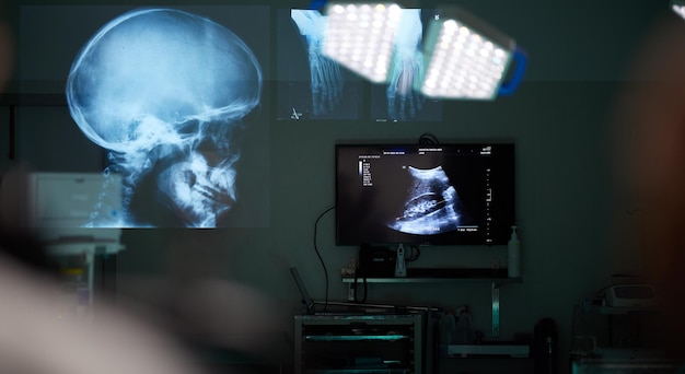 Zdjęcie radiografia sali chirurgicznej i czaszki z opieką medyczną, neurobiologią i opieką medyczną z diagnozą, holograficzne leczenie medyczne i szkielet z monitorem cyfrowym, a mózg z skanowaniem i anatomią badawczą