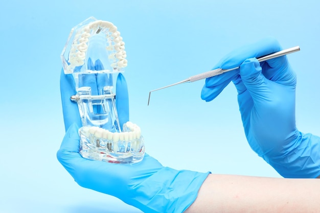 Ręce W Rękawiczkach Medycznych Trzymają Model Szczęki I Instrument Dentystyczny