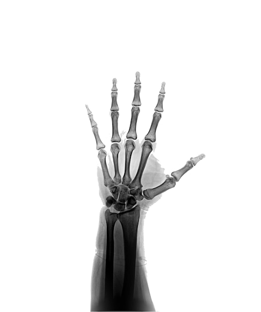 Ręka szkieletu ze słowem szkielet