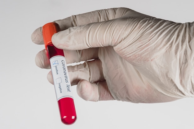 Ręka trzymająca probówkę próżniową z próbką krwi dla Covid19
