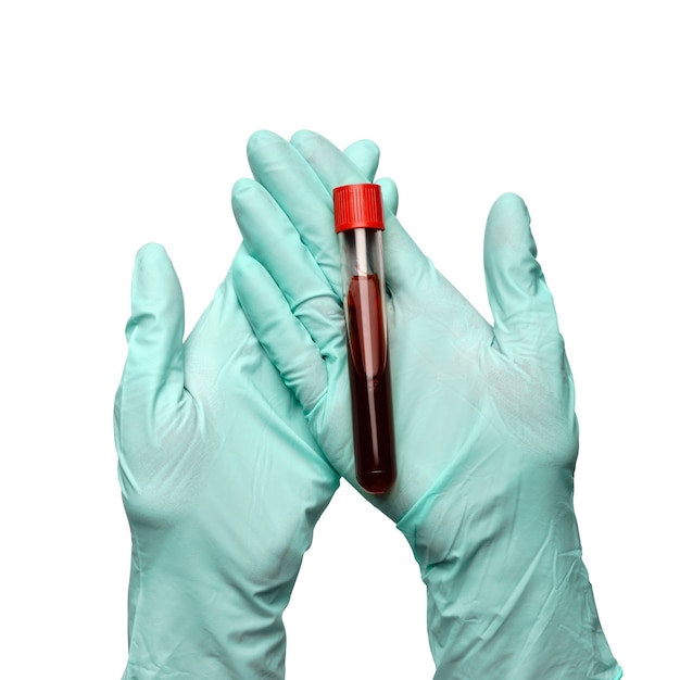 Ręka w rękawicy lateksowej, trzymając próbkę krwi w probówce z bliska na białym tle.