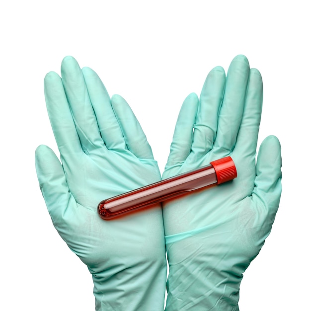 Ręka w rękawicy lateksowej, trzymając próbkę krwi w probówce z bliska na białym tle.
