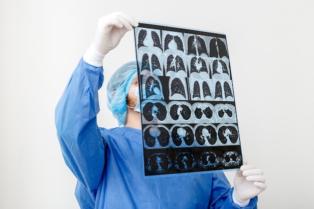 Skan płuc w rękach lekarza. Chirurg w mundurze ochronnym sprawdza film MRI.