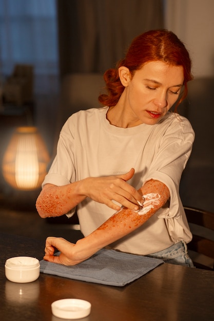 Zdjęcie Średnia kobieta z chorobą skóry