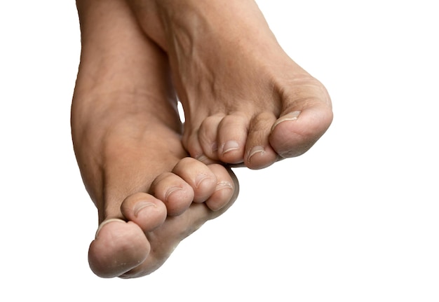 Zdjęcie stopy dorosłej kobiety rasy kaukaskiej na białym tle