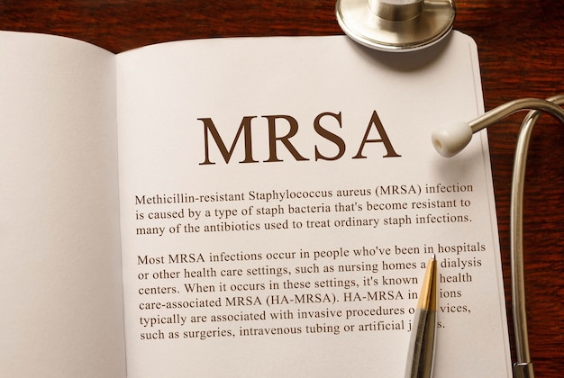 Strona z zakażeniem gronkowcem złocistym MRSA opornym na metycylinę na stole ze stetoskopem, koncepcja medyczna