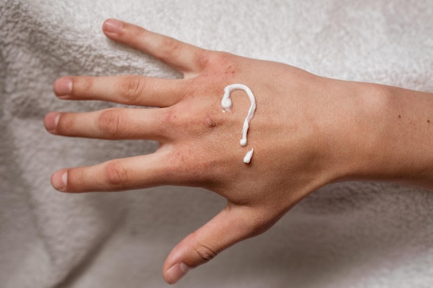 Zdjęcie suche dłonie z ranami na dłoniach maluje się kremem znak zapytania