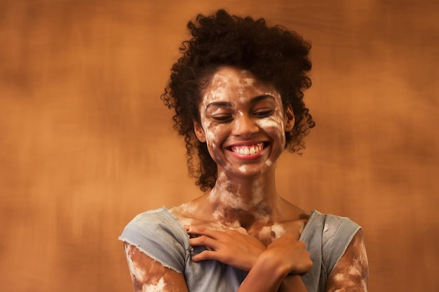 Szczęśliwa młoda kobieta z białaczką na brązowym tle Piękny naturalny unikalny odcień skóry