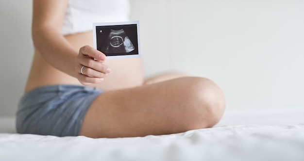 Zdjęcie szczęśliwego azjatyckiego kobieta w ciąży mienia mienia ultradźwięku wizerunek podczas gdy dotyka jej brzucha na łóżku. matka z usg jej nienarodzonego dziecka w białym pokoju, koncepcja ciąży, macierzyńska opieka prenatalna