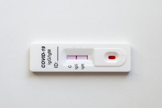 Szybki test krwi wykazuje pozytywny wynik na antygeny wirusa SARSCoV2 Test na chorobę wirusową COVID19 2019nCoV koronawirus