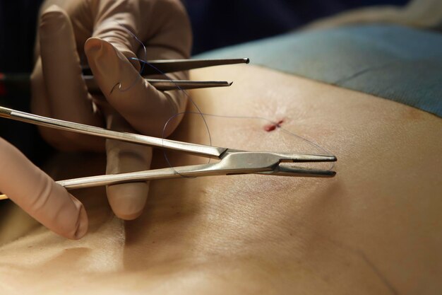 Zdjęcie szycie rany na sali operacyjnej