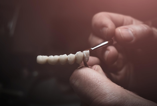 Technik Dentystyczny Wykonuje Protezę Zębów. Laboratorium. Zbliżenie.