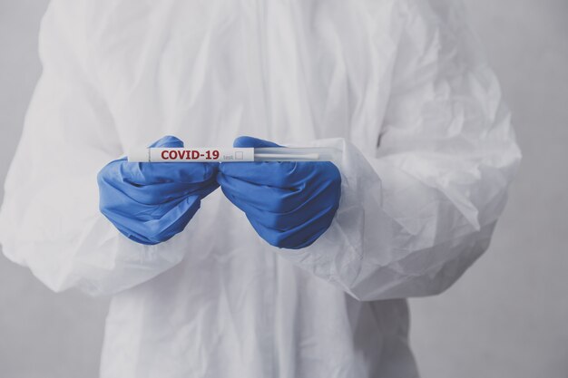 Technik laboratoryjny trzyma probówkę na koronawirusa do testu COVID-19.