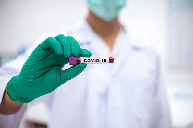 Technik Laboratoryjny Trzyma Probówkę Z Próbką Krwi Do Testu Koronawirusa