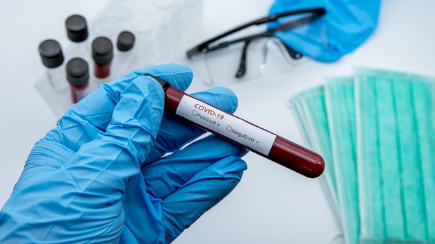 Technik laboratoryjny trzyma rękę na probówce z próbką krwi w celu wykonania testu na wirusa koronowego